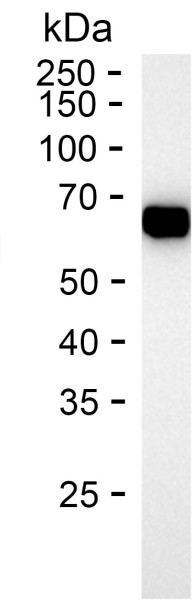 Recombinant Human HEXB Protein