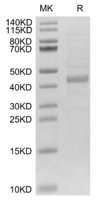 SFRP1/SARP2, His, Human