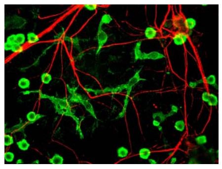 Anti-NF66 / alpha Internexin