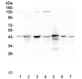 Anti-ADA / Adenosine deaminase, clone 6D4