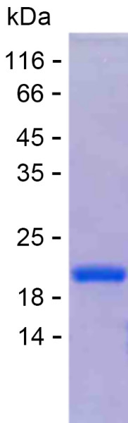 Recombinant Human Casein Kinase 2 beta Protein