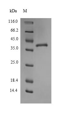 Thrombospondin-1 (Thbs1), partial, mouse, recombinant