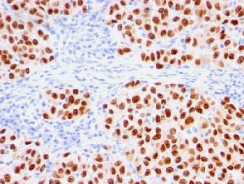 Anti-SOX10 (Melanoma Marker) Recombinant Mouse Monoclonal Antibody (clone:rSOX10/1074)