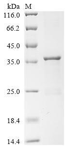 Arylamine N-acetyltransferase 1 (NAT1), recombinant human