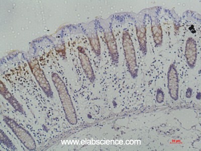 Anti-Galectin 3, clone 8D7