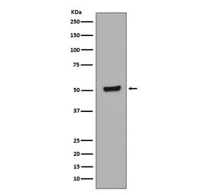 Anti-phospho-p53 / TP53 (Thr55), clone DGO-20