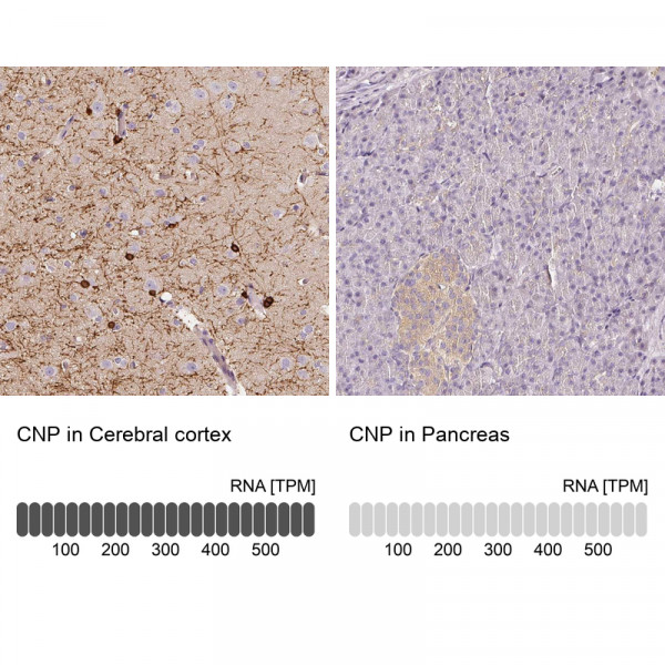 Anti-CNP