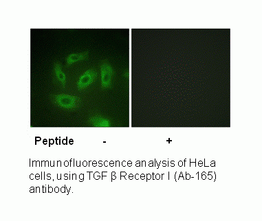 Anti-TGF beta Receptor I (Ab-165)