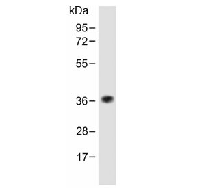 Anti-TAS2R5