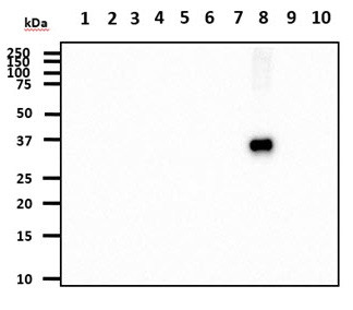 Anti-Cathepsin S, clone 1F9