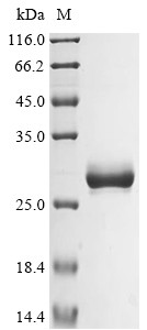Basement membrane-specific heparan sulfate proteoglycan core protein (HSPG2), partial, human, recomb