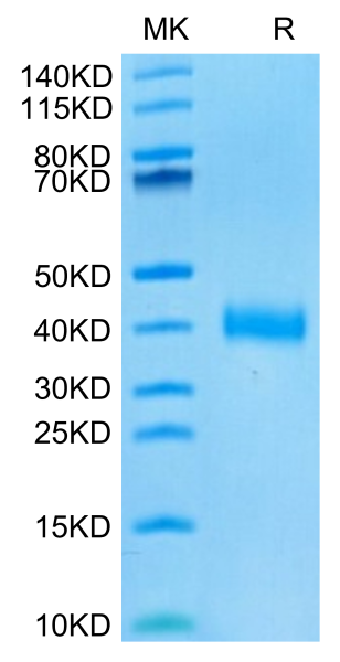 SARS-CoV-2 Spike RBD (Omicron BA.4/BA.5/BA.5.1.3/BA.5.2) Protein