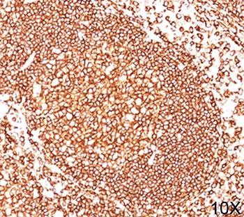 Anti-CD45 Cocktail, clone 2B11 + PD7/26