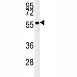 Anti-AKT2, clone 148CT5.4.1.4