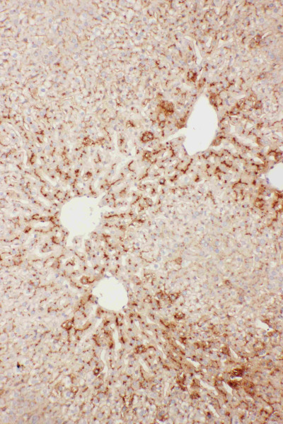 Anti-Serum amyloid P component