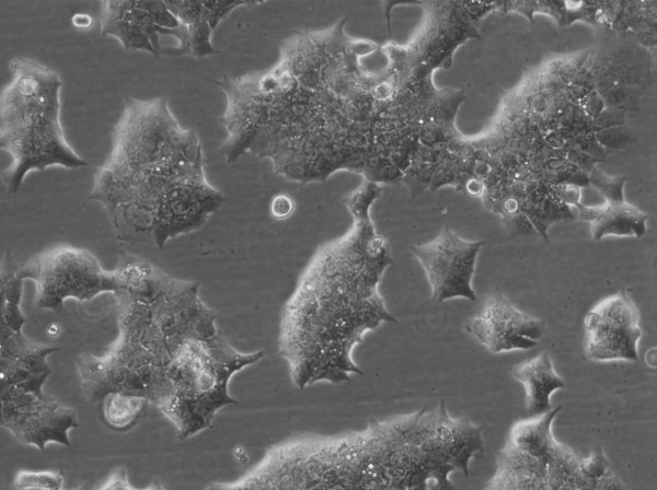 BT-474 Cells