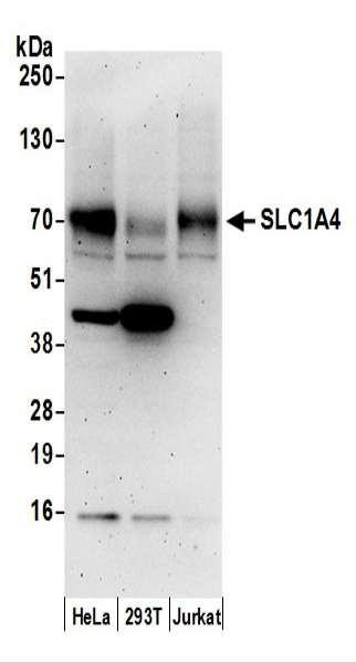 Anti-SLC1A4/ASCT1