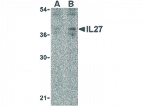 Anti-IL-27
