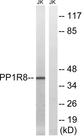 Anti-NIPP1
