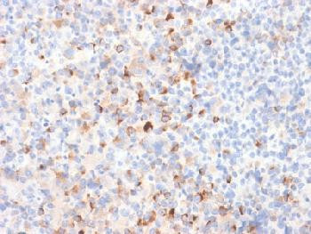 Anti-Tyrosinase (Melanoma Marker) Recombinant Rabbit Monoclonal Antibody (clone:TYR/2024R)