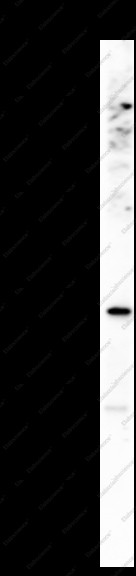 Anti-Recombinant NSE, clone C111924