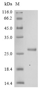 Interferon-activable protein 204 (Ifi204), partial, mouse, recombinant