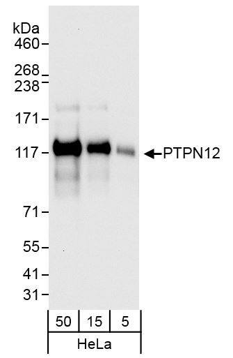 Anti-PTPN12