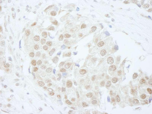 Anti-PUS1 (IHC)
