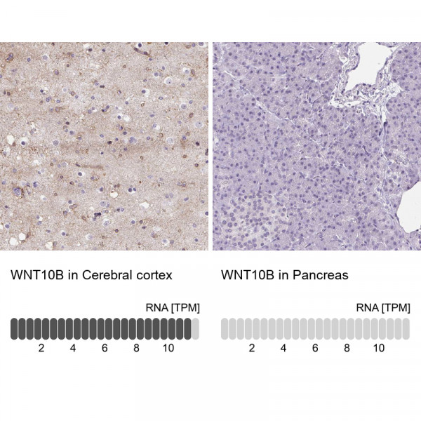 Anti-WNT10B
