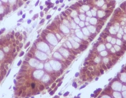 Anti-PPP2CA / PPP2CB