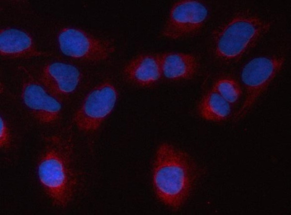 Anti-PSMC2