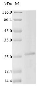 Troponin I, slow skeletal muscle (Tnni1), mouse, recombinant