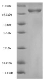 Cysteine sulfinic acid decarboxylase (Csad), mouse, recombinant