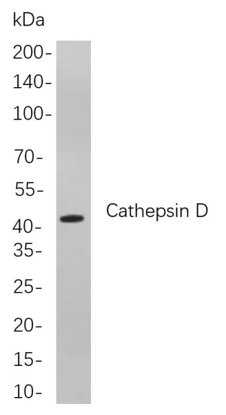 Anti-Recombinant Cathepsin D, clone 2B14