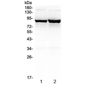 Anti-GAT-1 / GABA Transporter 1 / SLC6A1 (N-Terminal Region)