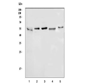 Anti-ATG5