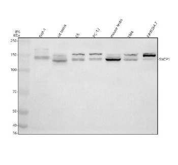 Anti-SYCP1 / Synaptonemal complex protein 1