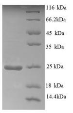 Aldehyde oxidase (AOX1), partial, human, recombinant