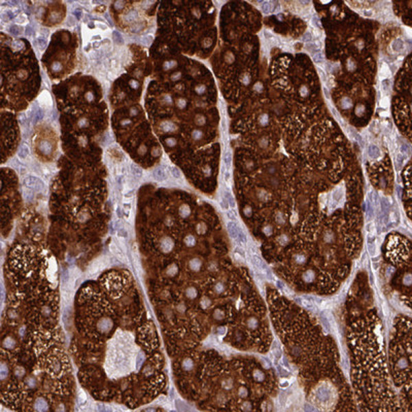 Anti-HSD3B1