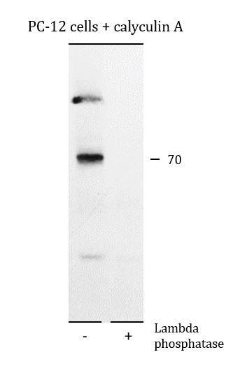 Anti-phospho-DPYSL2 / CRMP2 (Thr555), clone M539