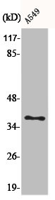 Anti-AKR1E2
