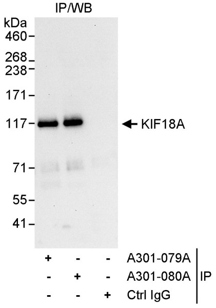 Anti-KIF18A