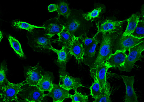 Anti-EGFR/HER1/ErbB1 Monoclonal Recombinant Antibody
