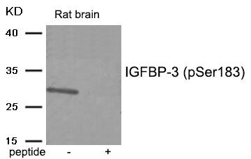 Anti-Phospho-IGFBP3 (Ser183)