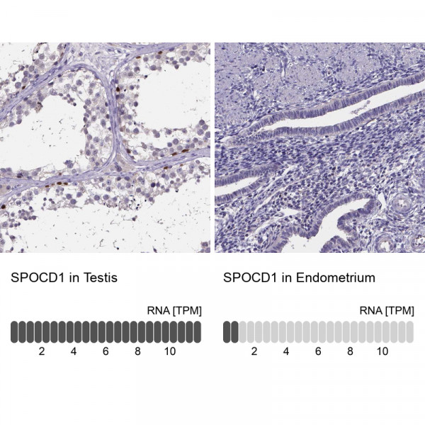 Anti-SPOCD1
