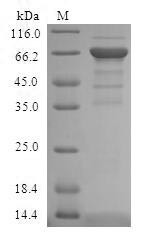 All-trans-retinol dehydrogenase [NAD (+)] ADH4 (ADH4), human, recombinant