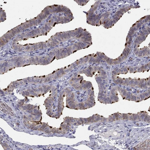 Anti-RSPH14