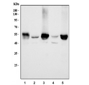 Anti-ALDH1B1