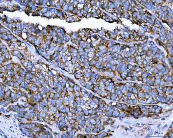 Anti-TRPM4