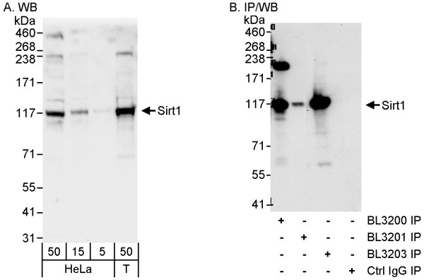 Anti-Sirt1